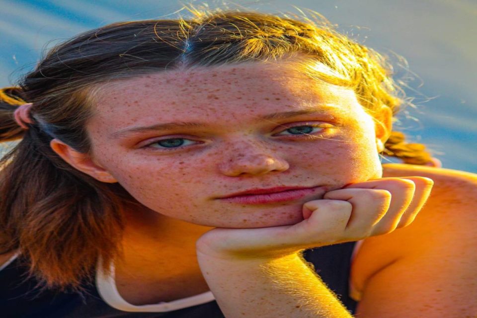 Epidermolysis Bullosa
