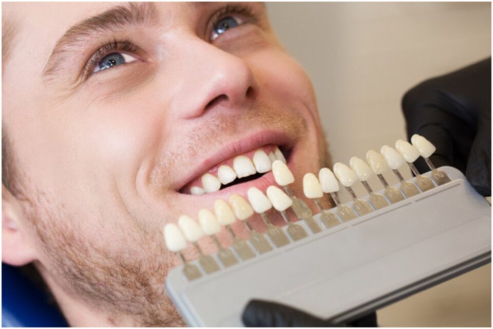 Dental Implants vs Bridges