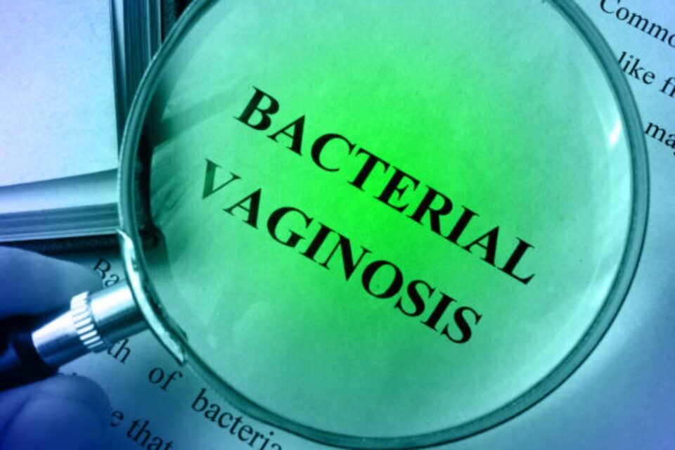 Bacterial Vaginosis