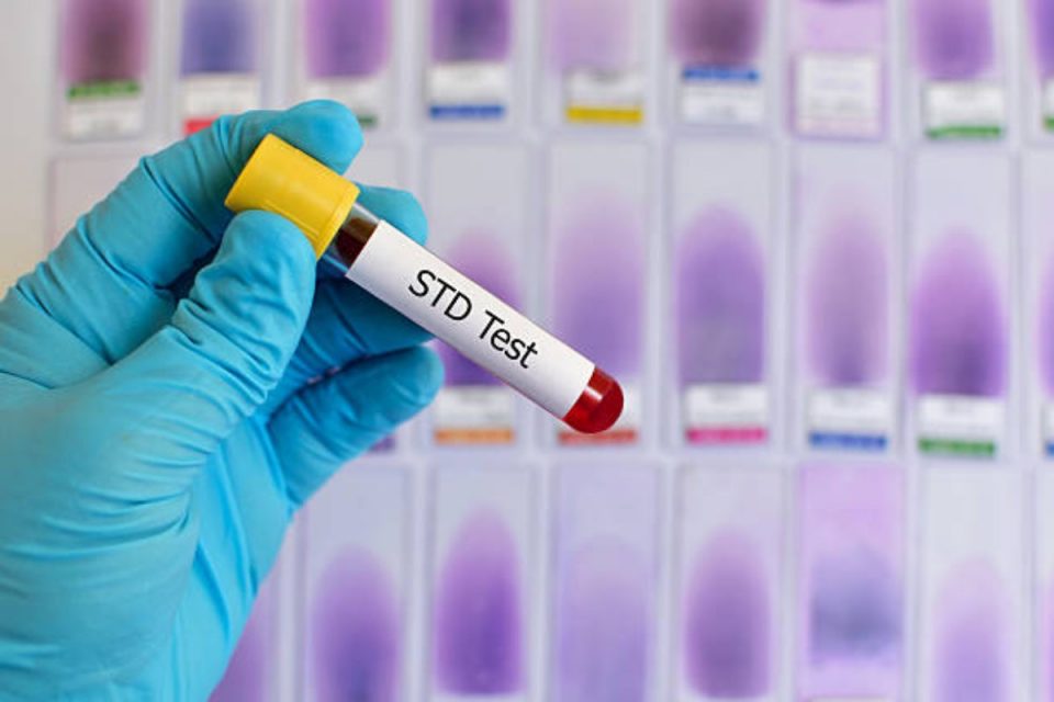 STD Testing