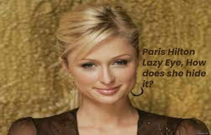 Paris Hilton Lazy Eye, How does she hide it?