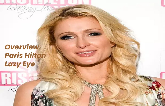Overview Paris Hilton Lazy Eye