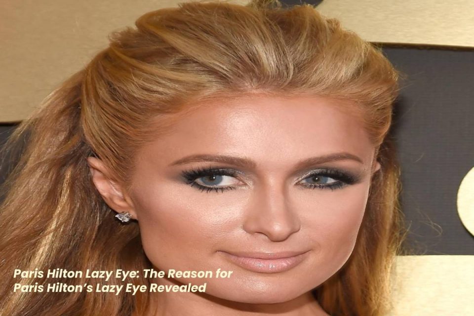 Paris Hilton Lazy Eye