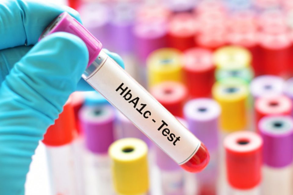 Hba1c test