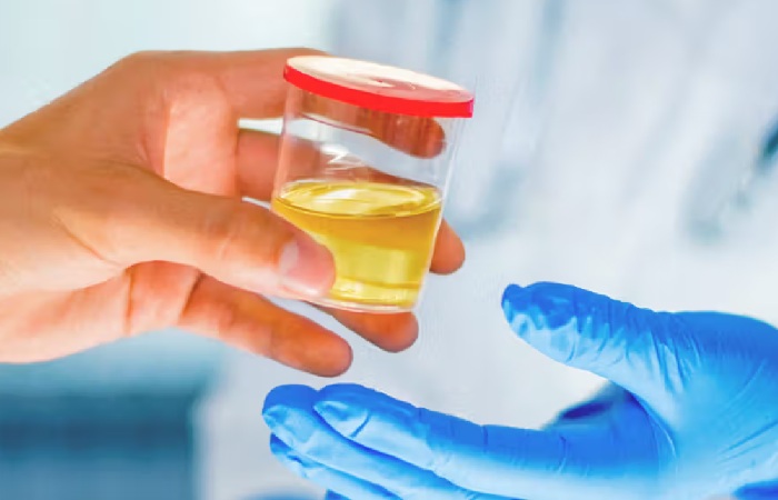 Pass Urine Drug Tests