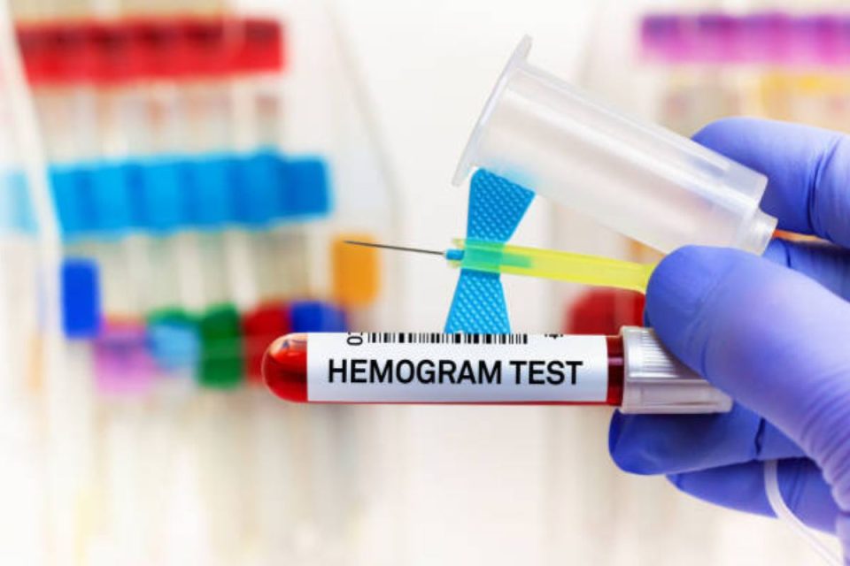 Hemogram test