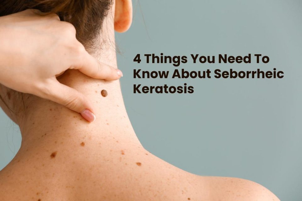 Seborrheic keratos