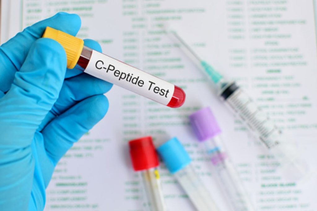 c peptide Test