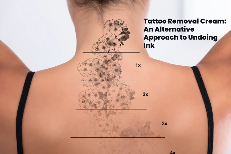 Tattoo Removal Cream