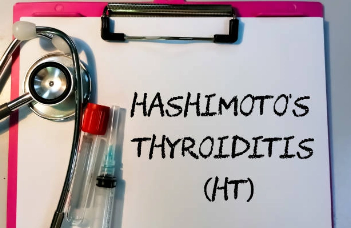 Hashimoto's Thyroiditis Write of Us- Overview