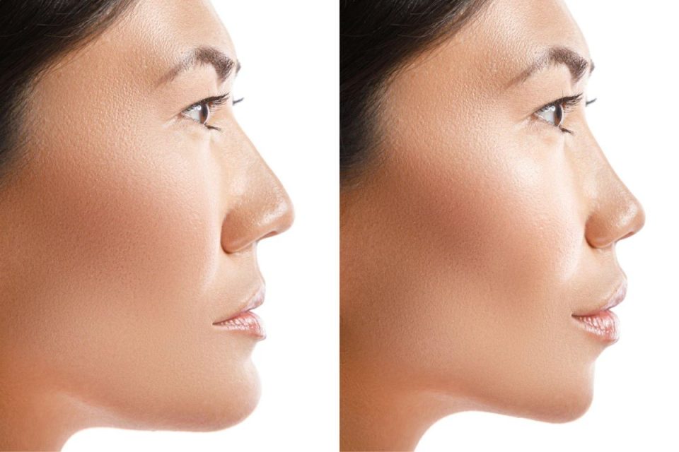 Quick Guide on Choosing Effective Skin Rejuvenation Solutions