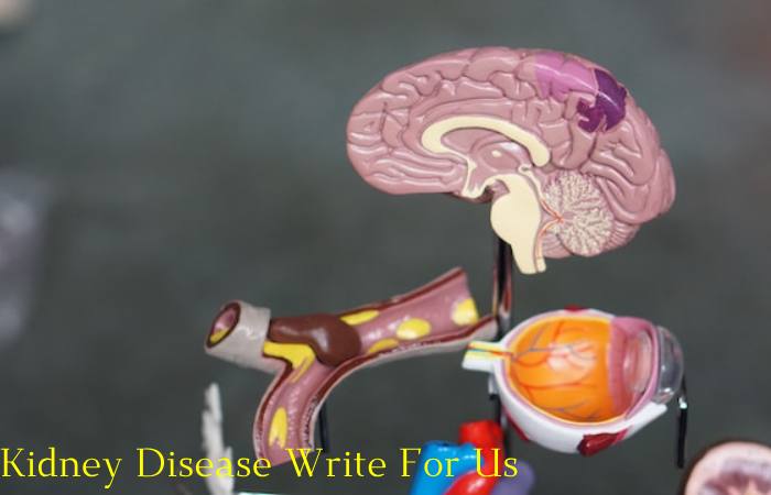 Kidney Disease Write For Us