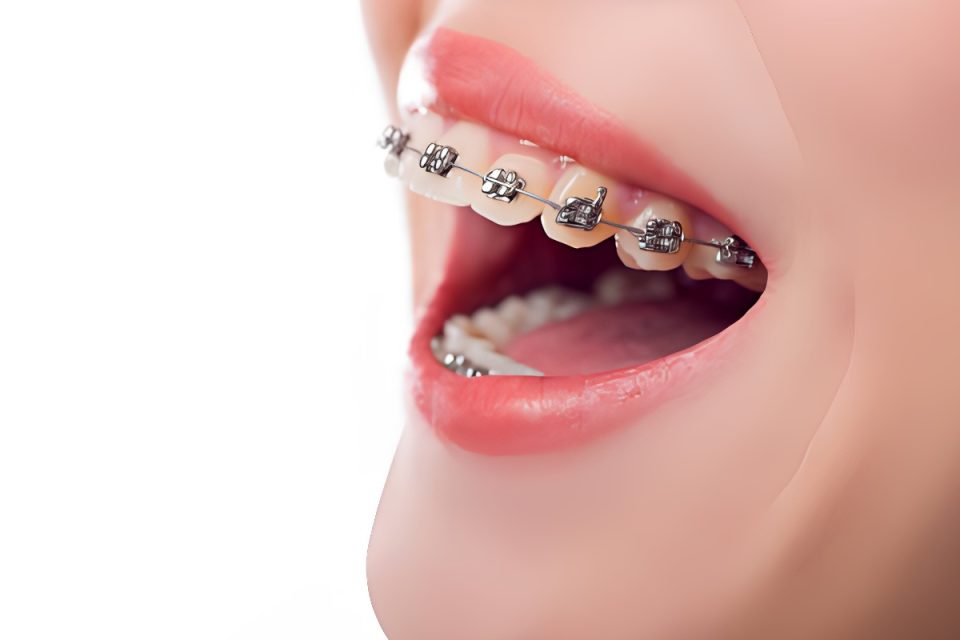 Top 6 Services To Look For In An Orthodontist in Queen Creek