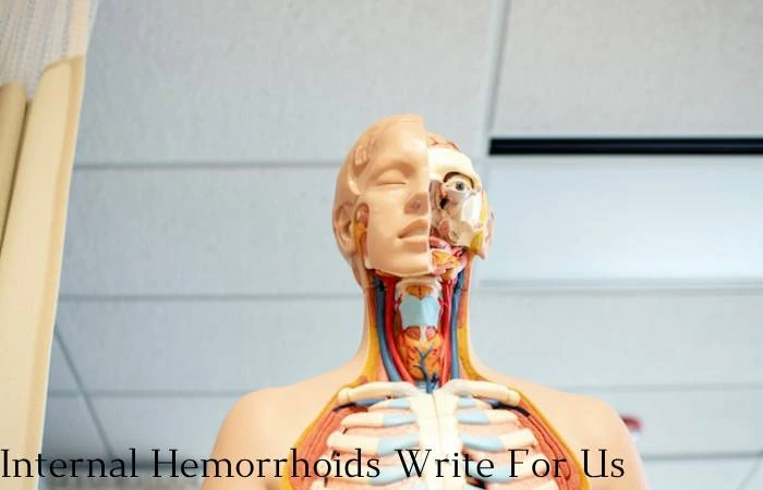 Internal Hemorrhoids Write for Us