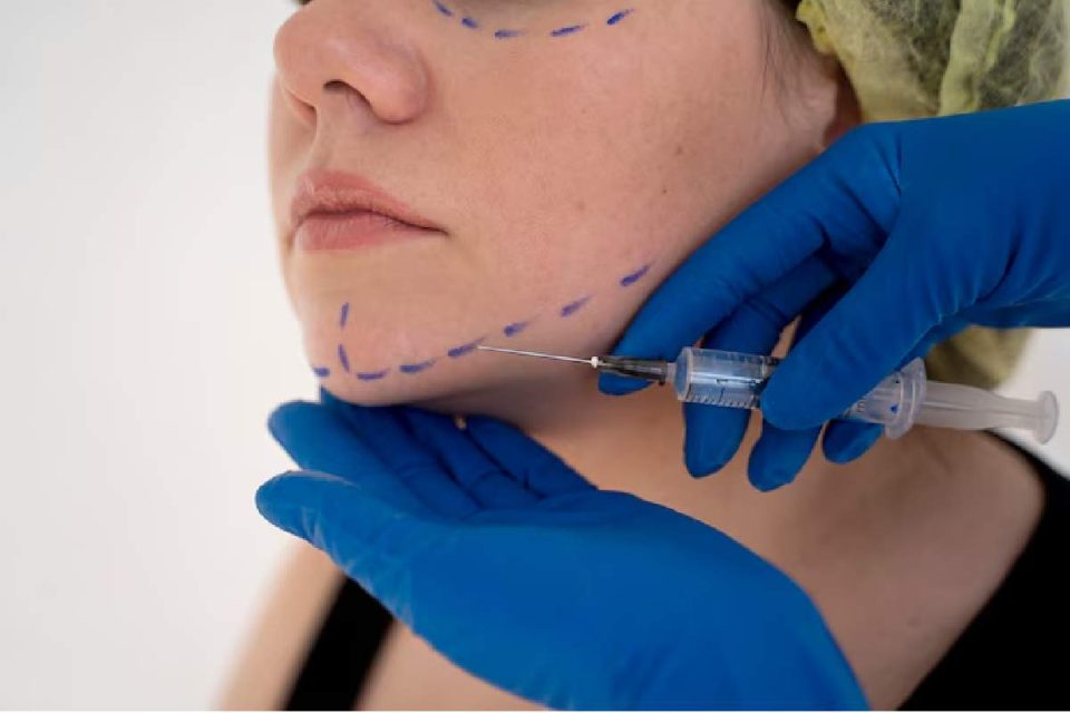 Necklift Surgery
