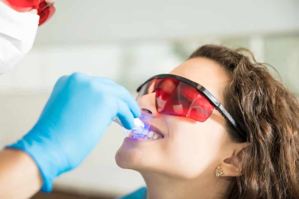 Teeth Whitening