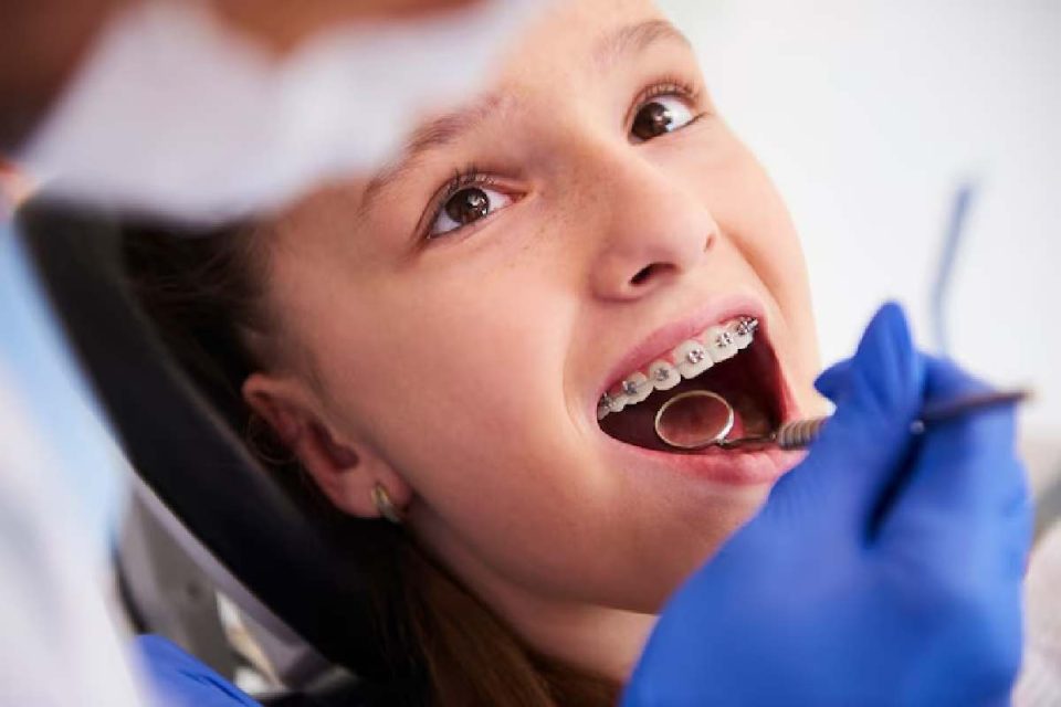Dental Retainers