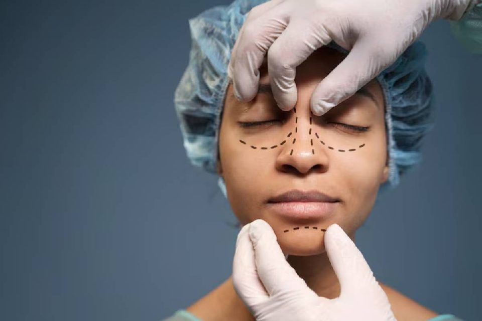 Rhinoplasty